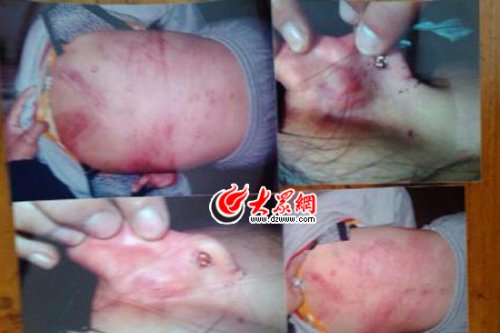 　山東藝術(shù)設(shè)計(jì)學(xué)院16歲女生宿舍內(nèi)被女同學(xué)暴打4小時(shí)。