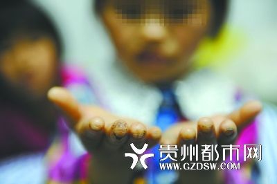 指尖被針扎得傷痕累累。