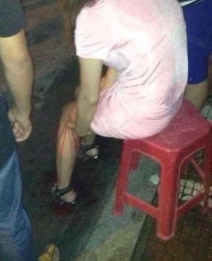 福州發(fā)生多起路人遭割肉事件 嫌疑人已被抓獲 福州發(fā)生多起路人遭割肉事件 嫌疑人已被抓獲