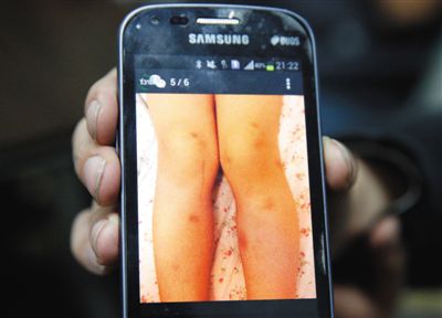 朝陽一幼兒園 女老師長(zhǎng)期打多名兒童