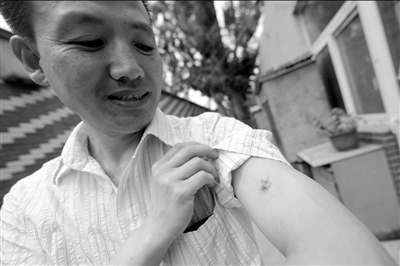 郭學(xué)江制服狂徒時被咬傷。京華時報記者潘之望攝