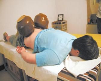 拔泡菜壇子火罐。