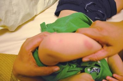 孩子身上有多處明顯傷痕。京華時報(bào)讀者供圖