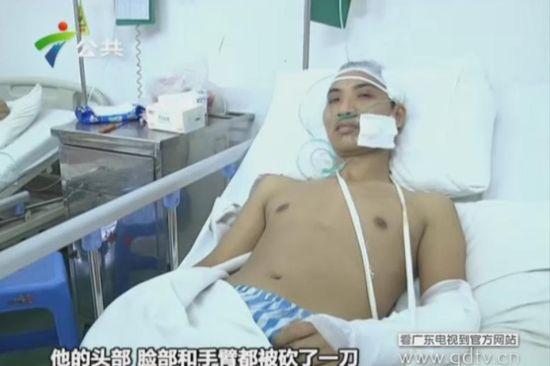 另一名傷者頭部、臉部和手臂都被砍了一刀。(視頻截圖)