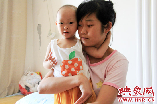 孩子和媽媽在一起，她的右眼已經(jīng)失明。