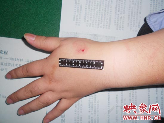 為幫助無證駕駛的朋友逃避處罰，新鄉(xiāng)的王某竟對執(zhí)勤民警大打出手，還將一名民警的手臂咬傷