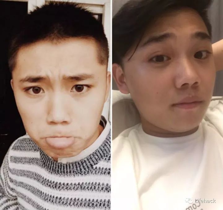 長胖20斤，臉型怎么變？這些例子看完扎心了！