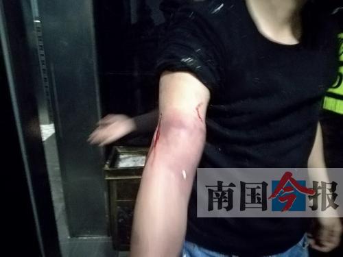 覃先生手臂被卡的部位受傷流血，所幸傷勢(shì)無(wú)大礙。 通訊員 王建民 攝