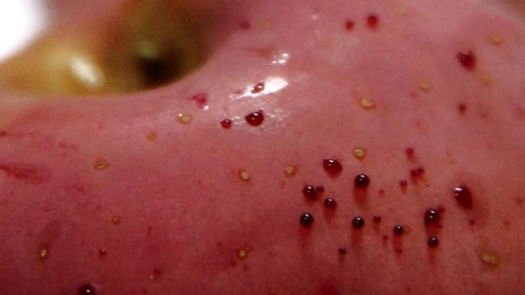 嚇懵！女子用熱水泡蘋果結(jié)果冒出血珠 咋回事？