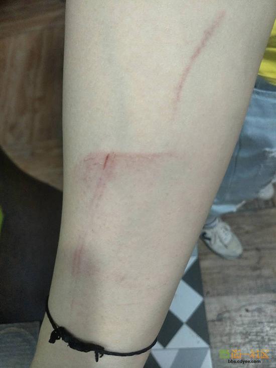 女網友舉報網帖中出示的被打后照片。