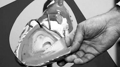 威廉斯領(lǐng)導(dǎo)的研究團(tuán)隊已經(jīng)利用人體脂肪干細(xì)胞，成功3D打印出心臟血管和心臟瓣膜，待一顆心臟的所有部件打