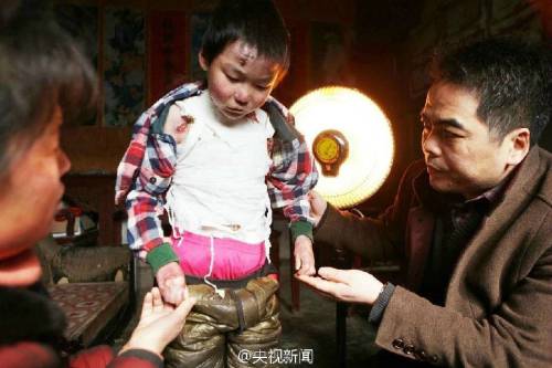 男孩皮膚一碰就破 裹衛(wèi)生紙堅持上學 男孩皮膚一碰就破 裹衛(wèi)生紙堅持上學