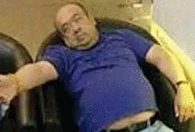 網(wǎng)傳金正男中毒后的照片。