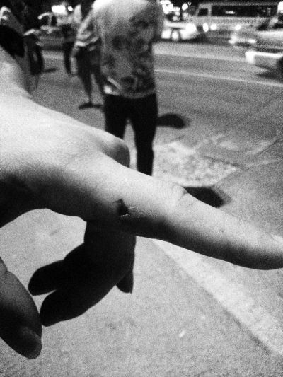 民警食指被咬傷。