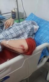 砸窗當(dāng)事人胡女士在醫(yī)院接受治療。