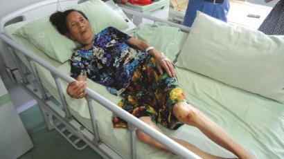 躺在病床上的受傷者李獻(xiàn)瑞 躺在病床上的受傷者李獻(xiàn)瑞