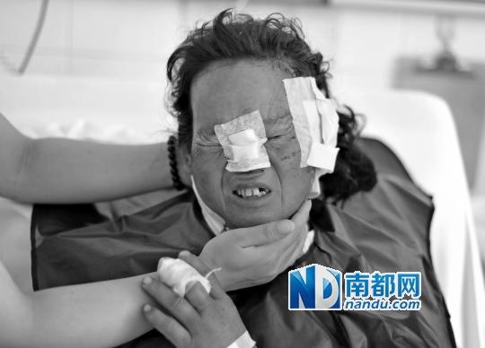 受狼群襲擊受傷較重的村民在接受救治。C FP圖片