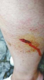 郭女士腿上被猴子咬的傷口。(受訪者供圖)